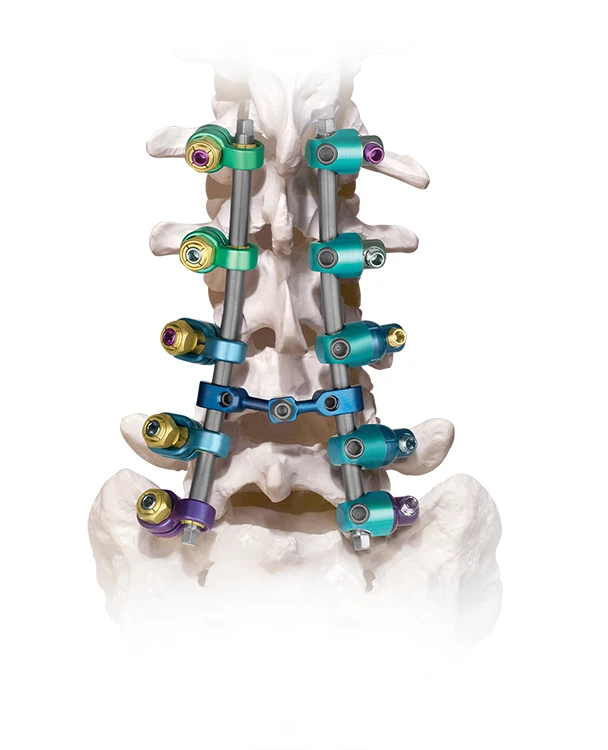 BEACON® Stabilization System on spine
