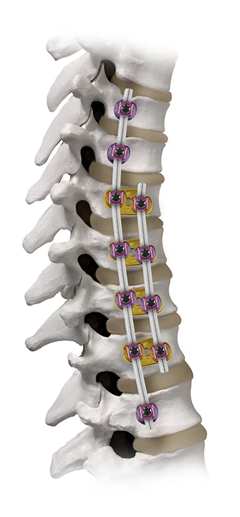REFLECT on spine