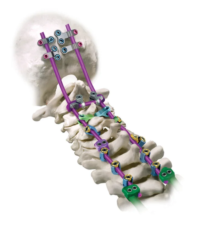 PROTEX CT on spine