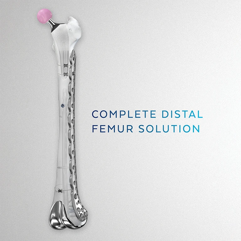 Complete Distal Femur Solution thumbnail