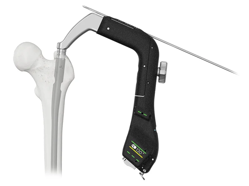 AUTOBAHN Troch Nail PRO with guidewire