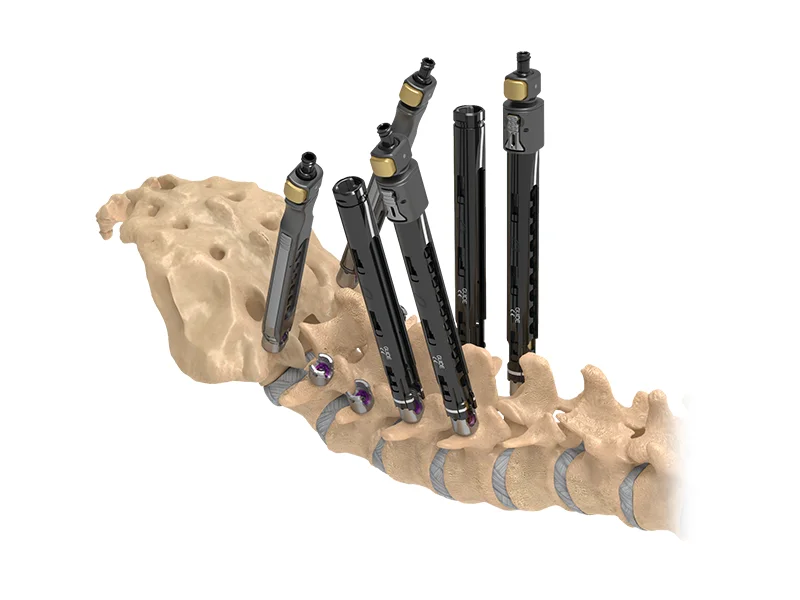 Reline Fenestrated