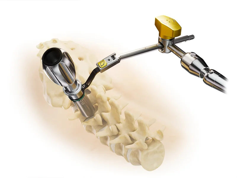 NuVasive Tube System