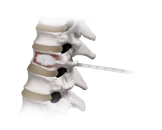 Spine