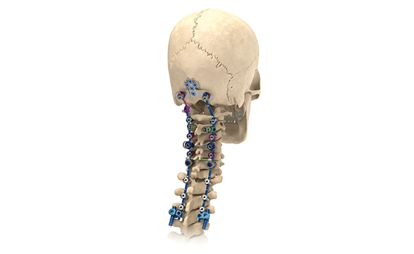 Reline Cervical