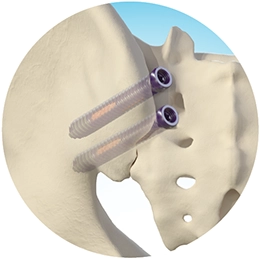 Posterior Medial to Lateral