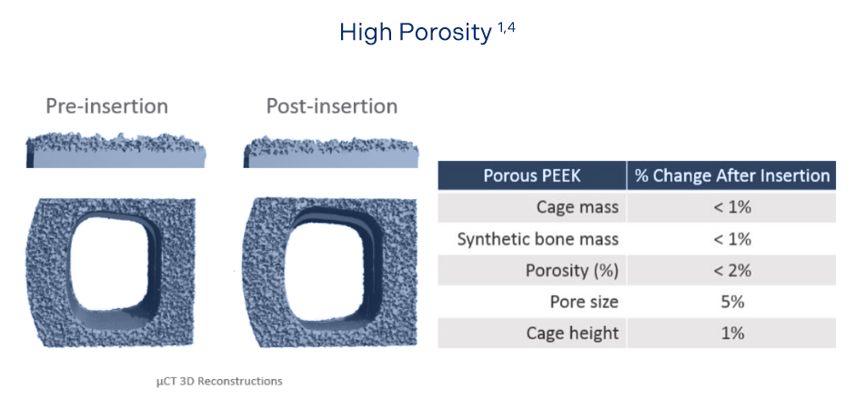 Porosity table
