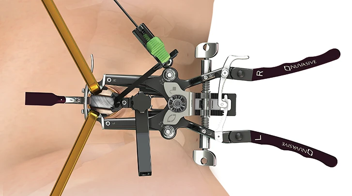 MaXcess 4 retractor
