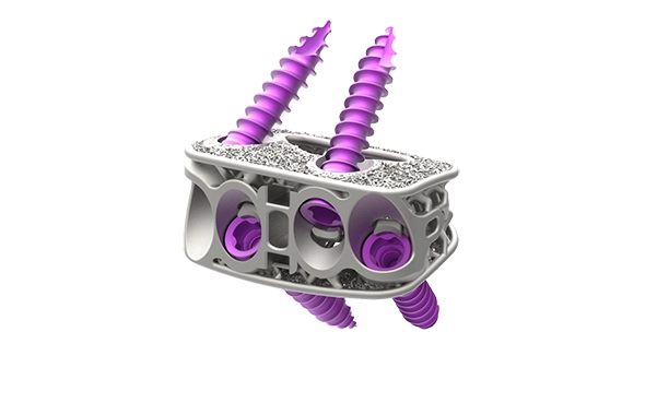 Modulus ALIF spacer