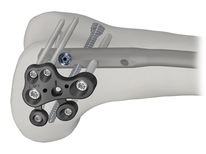 AUTOBAHN EVO Retrograde locking washer