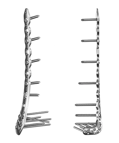 ANTHEM Distal Tibia