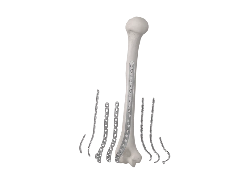ANTHEM Elbow Fracture System